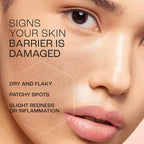 Lakme Peach Pro Ceramide Moisturizer with Vitamin E,For Dry Skin,Normal Skin & Sensitive Skin [200 ml]