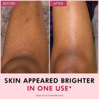 Mcaffeine Brightening Raspberry Rush Body Scrub Removes Tan & Brightens Skin [175 g]