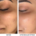 O3+ Meladerm Vitamin C Gel Bleach For Dullness Removal, Hydration & Glowing Skin, All Skin Types [96 g]