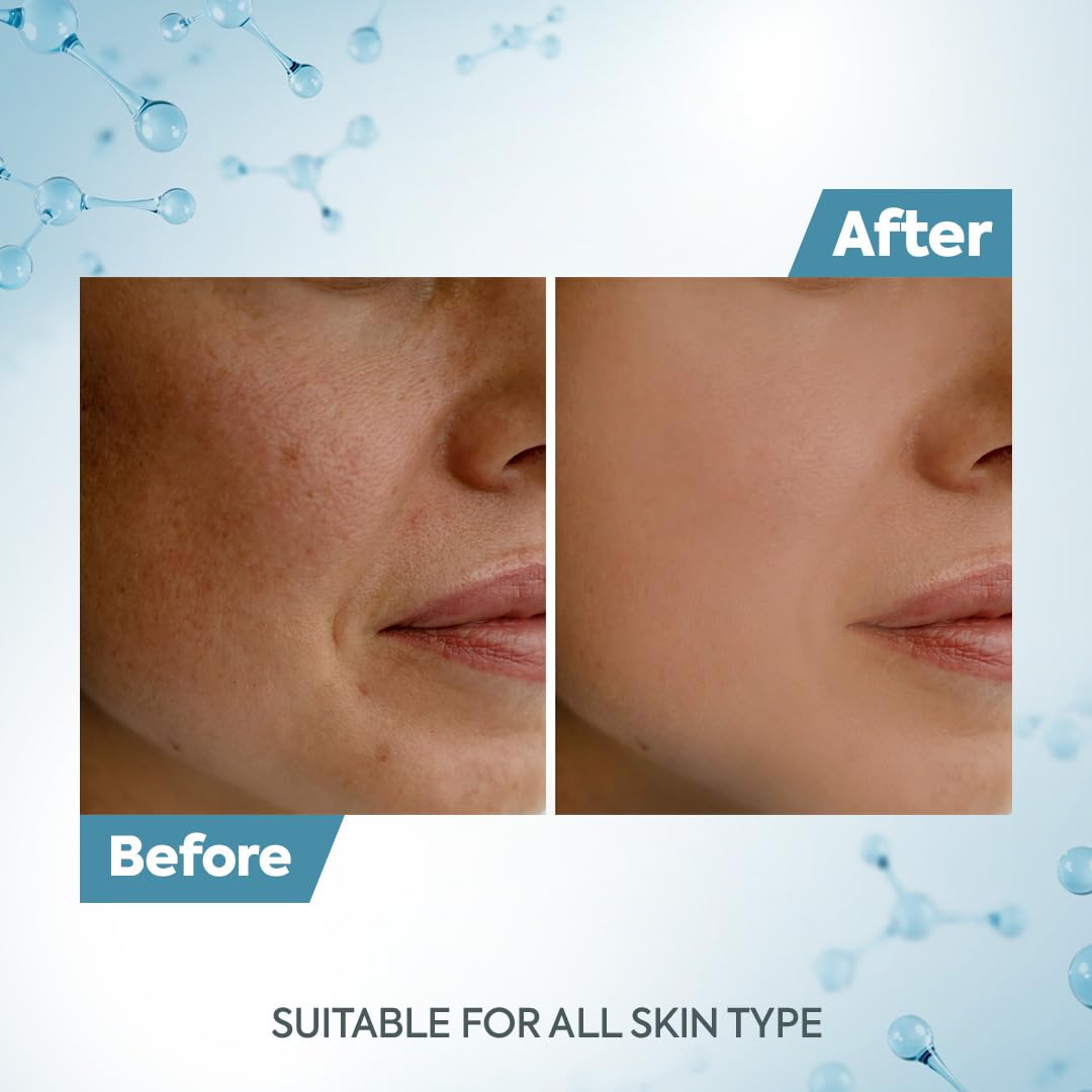 Raaga Professional De Tan Removal Creme With Kojic & Milk [500 g]